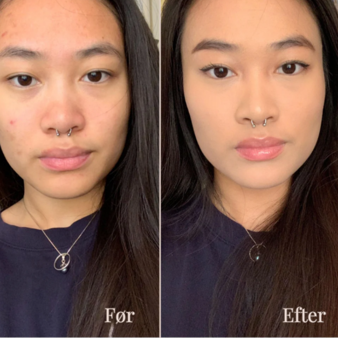 LysFix | Farve Korrigerende Concealer