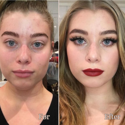 LysFix | Farve Korrigerende Concealer