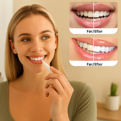 PerleHvid | Tandblekningspenna – Kliniskt inspirerad blekning hemma